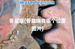 骨盆痛(骨盆痛在哪个位置图片)