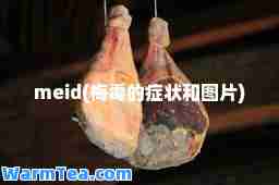 meid(梅毒的症状和图片)