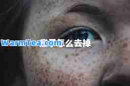 瘊子怎么去掉